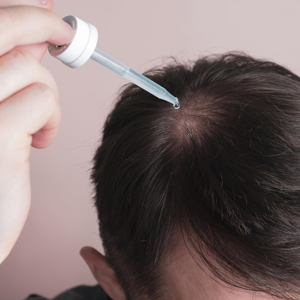 Minoxidil 5% Extra Forte para Homens - Miniatura 5